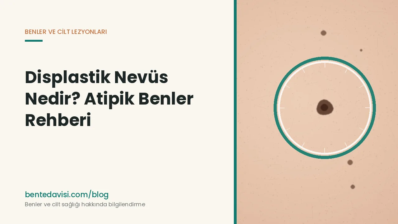 Displastik Nevüs Nedir? Atipik Benler Rehberi